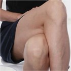 Целлюлит в неожиданных местах: когда апельсиновая корка не только на бедрах