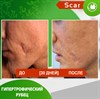 Карипаин Scar гель ферментный для кожи с Коллагеназой и Тизолем 40 мл. 3924 - фото 15142